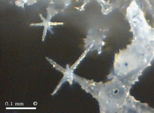 Photomicrograph, hexactines