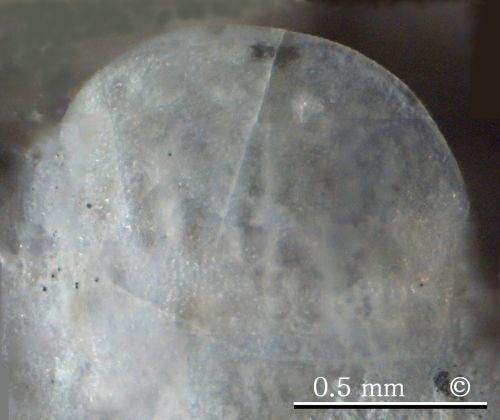 Photomicrograph, gastral surface