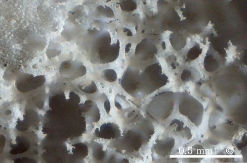 Photomicrograph, skeleton