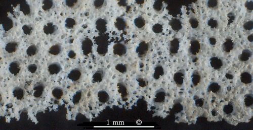 Photomicrograph, dermal pores